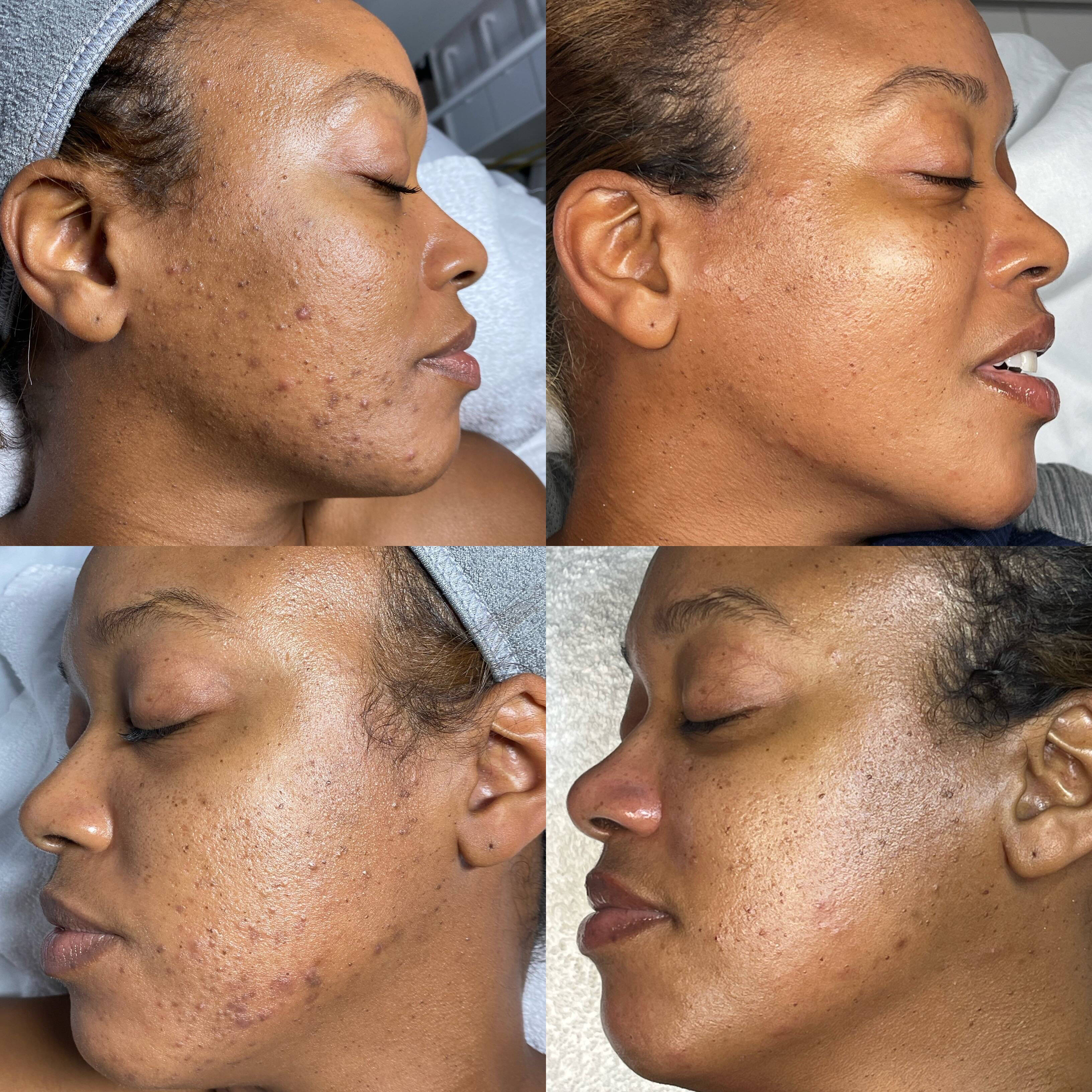 Home | Nik's Skin Los Angeles